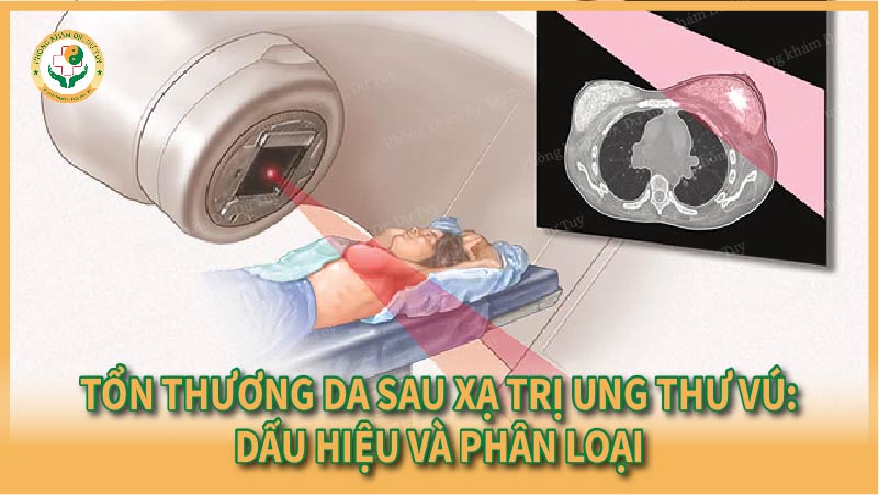 Tổn thương da sau xạ trị ung thư vú: Dấu hiệu và phân loại