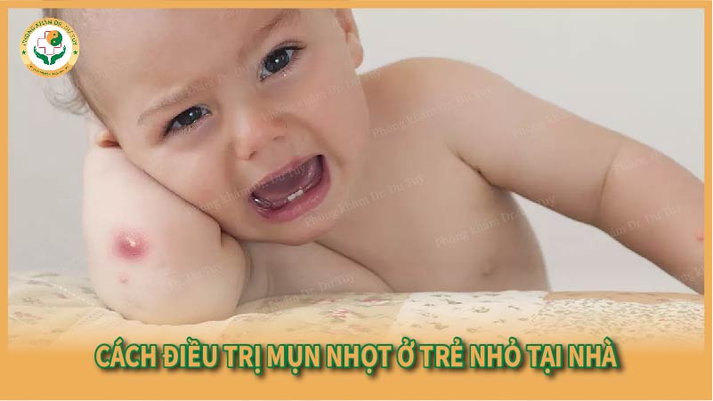 Cách điều trị mụn nhọt ở trẻ nhỏ tại nhà