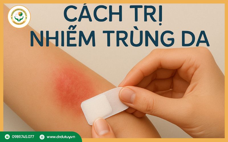 Nhiễm trùng da là gì? Cách trị nhiễm trùng da an toàn