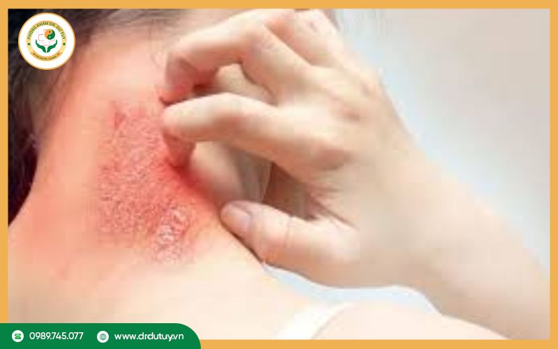 Nguyên nhân gây nhiễm trùng da