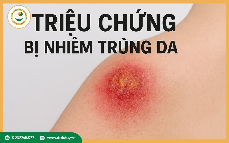 Triệu chứng bị nhiễm trùng da