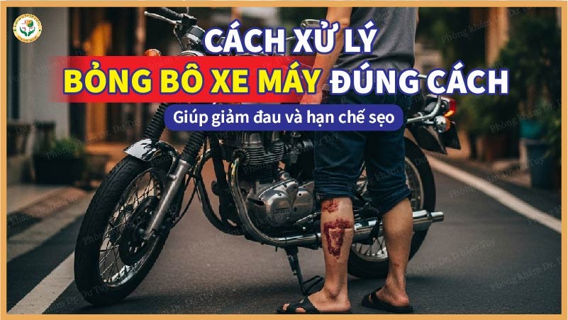 Cách xử lý bỏng bô xe máy đúng cách giúp giảm đau và hạn chế sẹo
