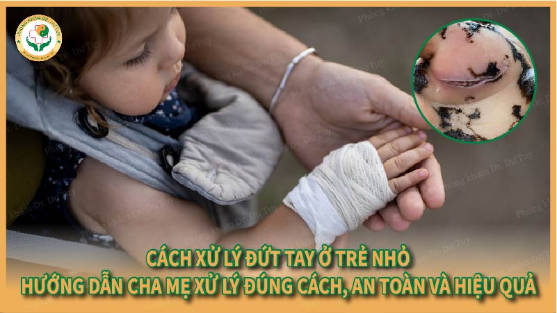 Cách xử lý đứt tay ở trẻ nhỏ- Hướng dẫn cha mẹ xử lý đúng cách, an toàn và hiệu quả