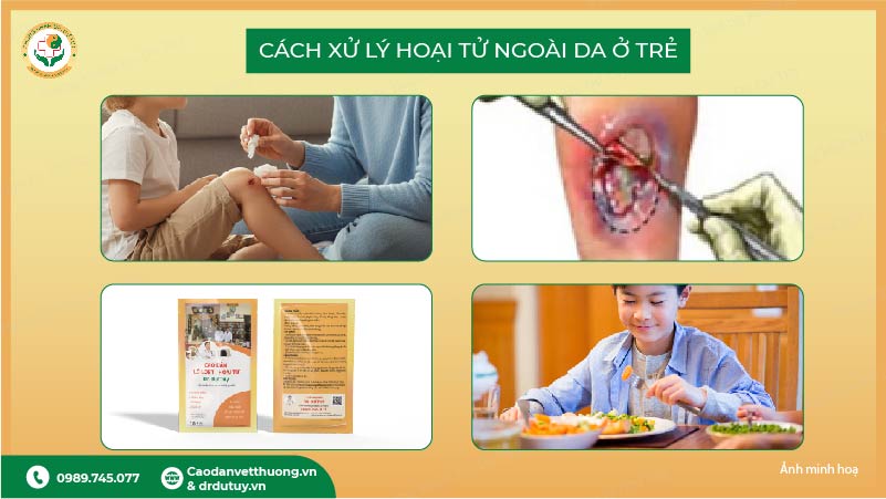 cách xử lý hoại tử da ở trẻ