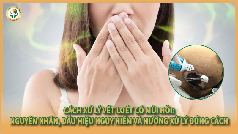Cách xử lý vết loét có mùi hôi: Nguyên nhân, dấu hiệu nguy hiểm và hướng xử lý đúng cách