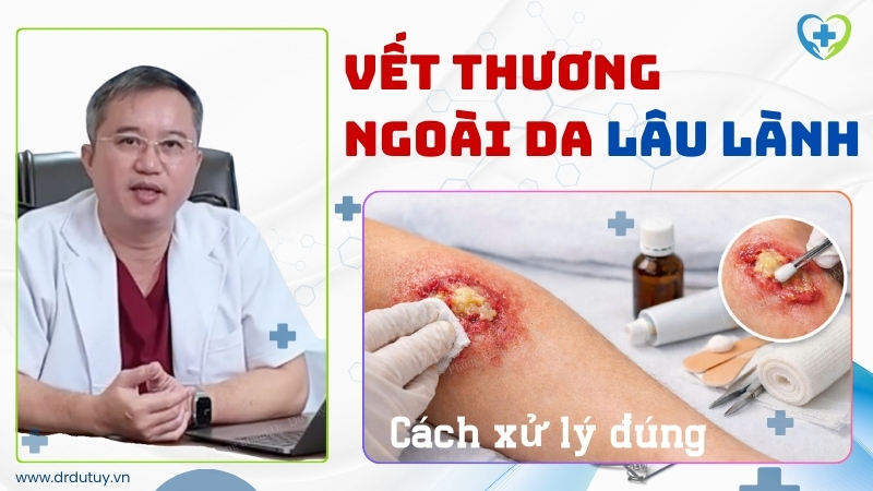 Vết thương ngoài da lâu lành, mưng mủ: Nguyên nhân – Cách xử lý đúng giúp vết thương nhanh lành