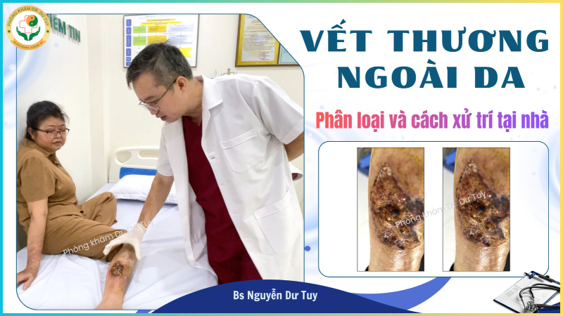 cách xử lý vết thương ngoài da tại nhà