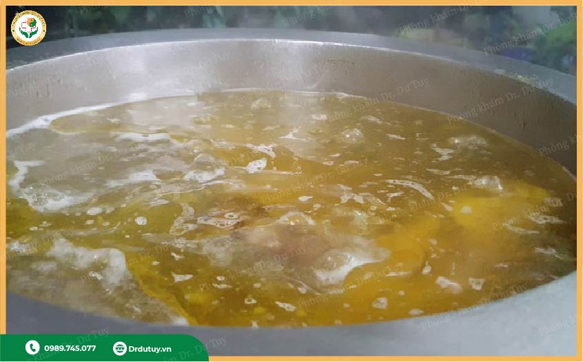 cách xử trí bỏng nước sôi