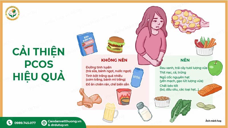 cải thiện pcos ăn uống nên và không nên