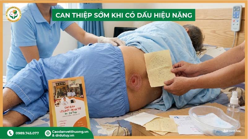 can thiệp sớm khi có dấu hiệu loét tỳ đè nặng
