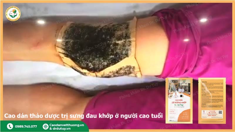 cao dán Dr. Dư Tuy hỗ trợ giảm đau khớp gối
