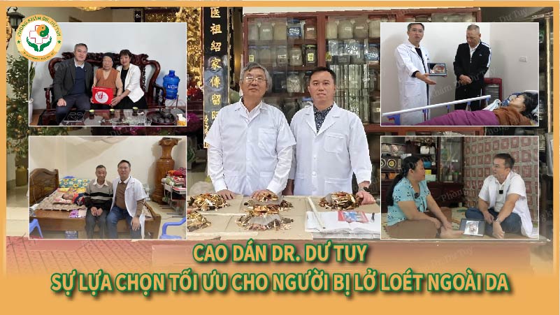Cao dán Dr. Dư Tuy- Sự lựa chọn tối ưu cho người bị lở loét ngoài da