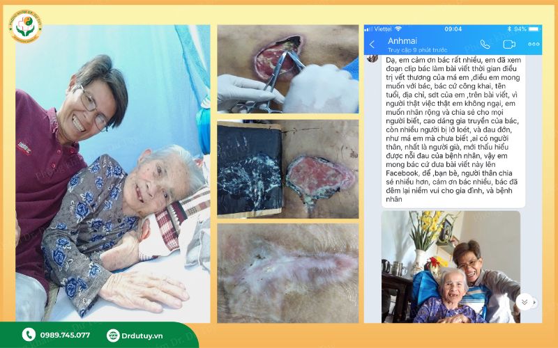lcao dán gia truyền trị lở loét