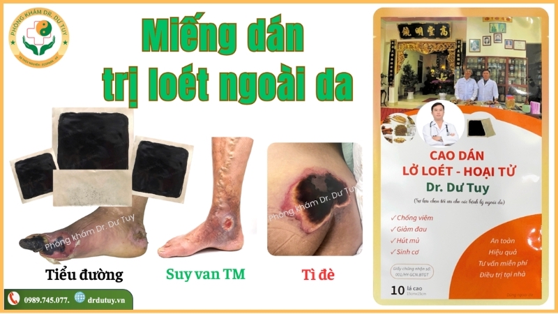 cao dán hỗ trợ chăm sóc loét ngoài da Dr. Dư Tuy