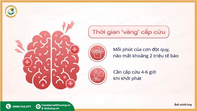 cấp cứu đột quỵ 4-5 giờ vàng