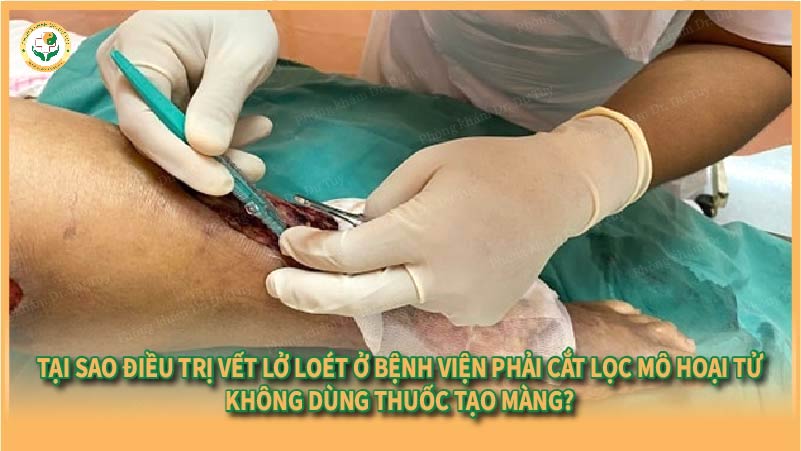 Tại sao điều trị vết lở loét ở bệnh viện phải cắt lọc mô hoại tử, không dùng thuốc tạo màng?