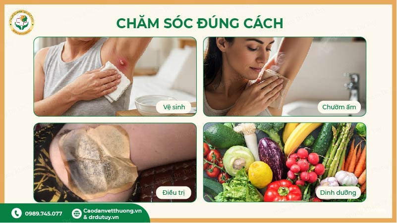 chăm sóc áp xe nách đúng cách