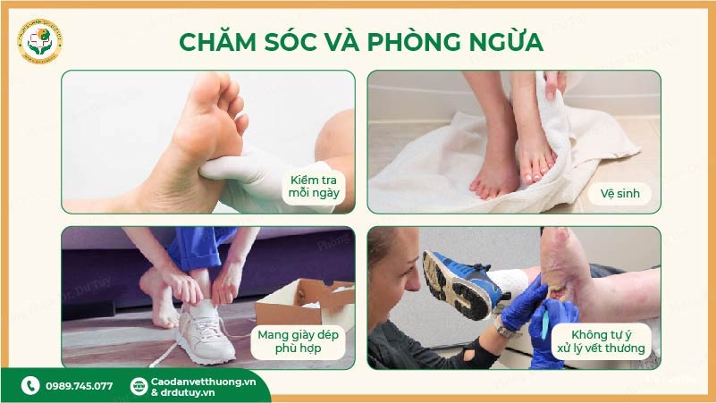 chăm sóc bàn chân người tiểu đường