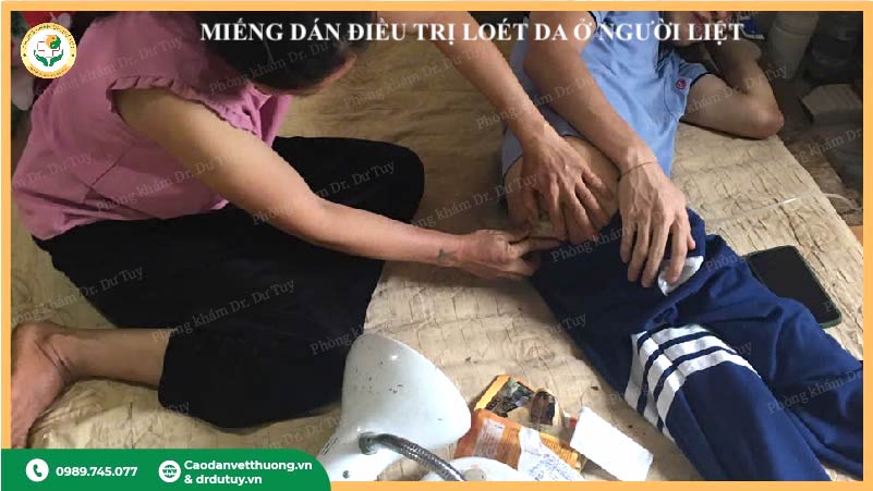 chăm sóc vết lở loét sau cắt lọc mô hoại tử