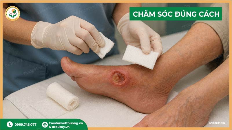 chắm sóc vết loét đúng cách
