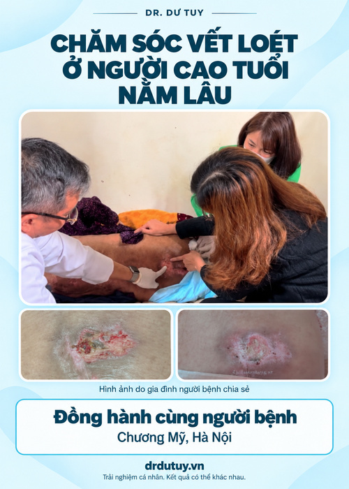 Lở loét da ở người nằm bất động lâu