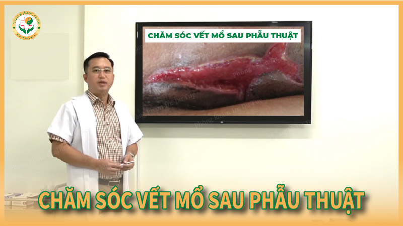 Cao dán Dr. Dư Tuy – Giải pháp chăm sóc vết mổ sau phẫu thuật hiệu quả tại nhà