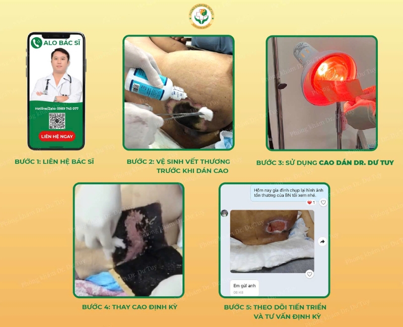 chăm sóc vết mổ sau phẫu thuật