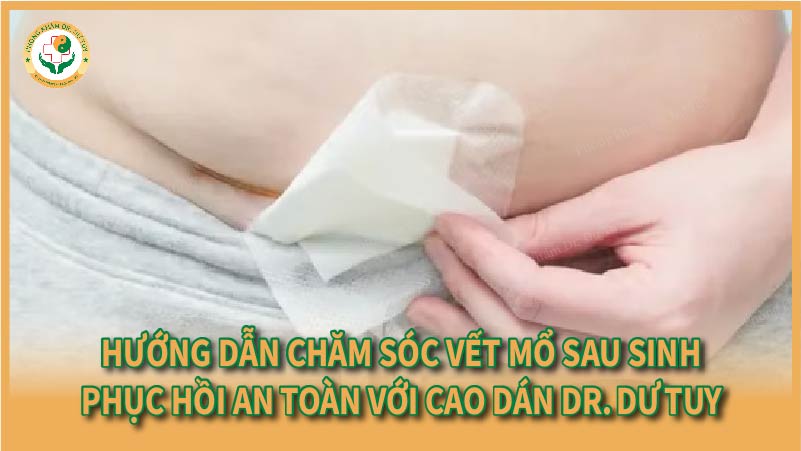Hướng dẫn chăm sóc vết mổ sau sinh – Phục hồi an toàn với Cao dán Dr. Dư Tuy