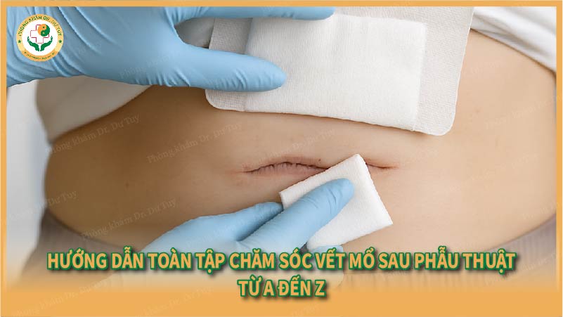 Hướng dẫn toàn tập chăm sóc vết mổ sau phẫu thuật từ A đến Z