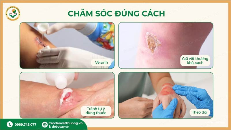 chăm sóc vết thương đúng cách
