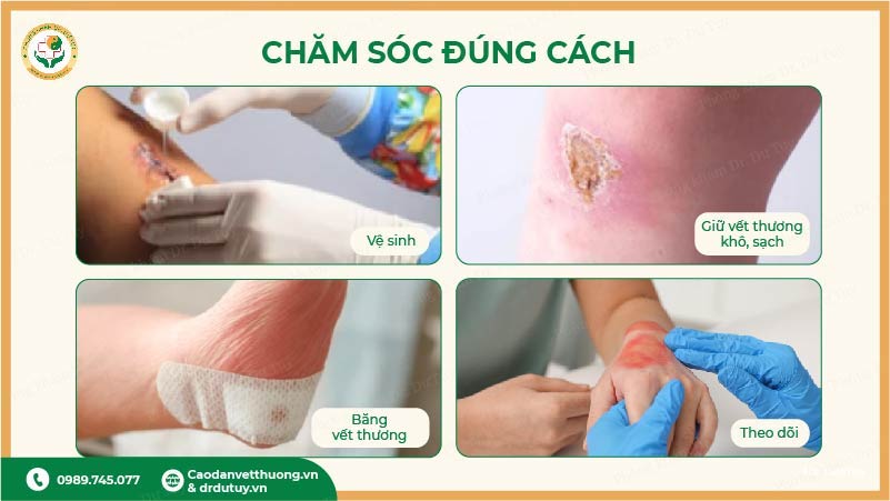 chăm sóc vết thương đúng cách
