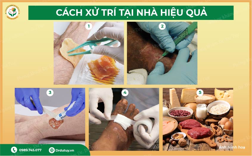 chăm sóc vết thương nhiễm trùng