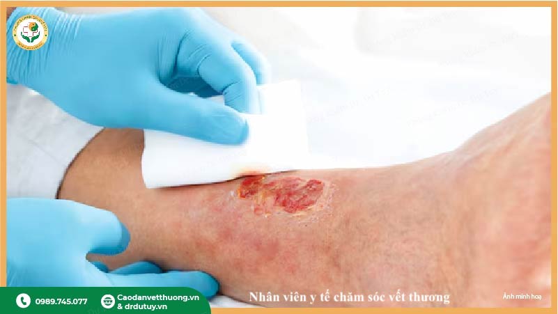 chăm sóc vết trầy xước đúng cách