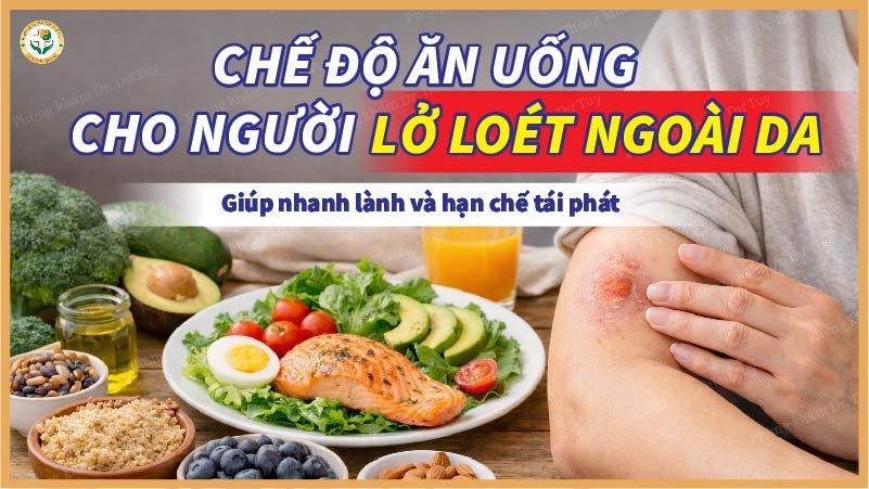 Chế độ ăn uống cho người bị lở loét ngoài da giúp nhanh lành và hạn chế tái phát
