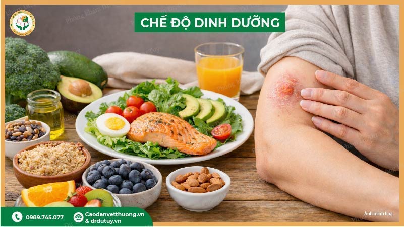 chế độ dinh dưỡng giúp vết bỏng nhanh lành