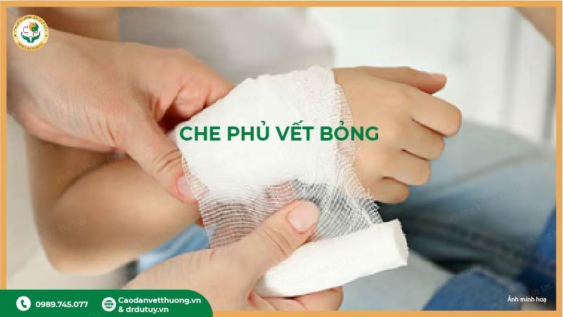 che phủ vết bỏng bằng gạc vô trùng