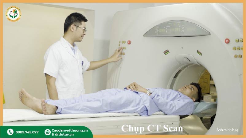 chụp CT Scan chẩn đoán ung thư hạch