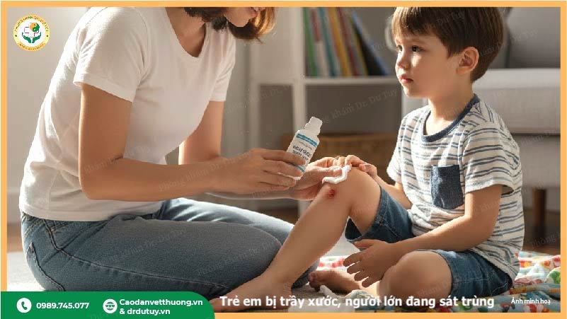 có nên dùng oxy già cồn cho vết thương ngoài da