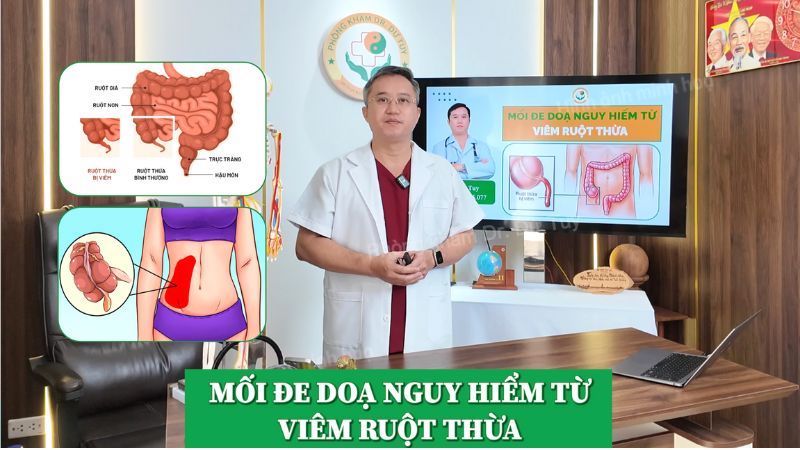 Mối đe doạ nguy hiểm từ viêm ruột thừa