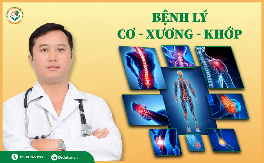 Thành phần của cao dán xương khớp Đông y