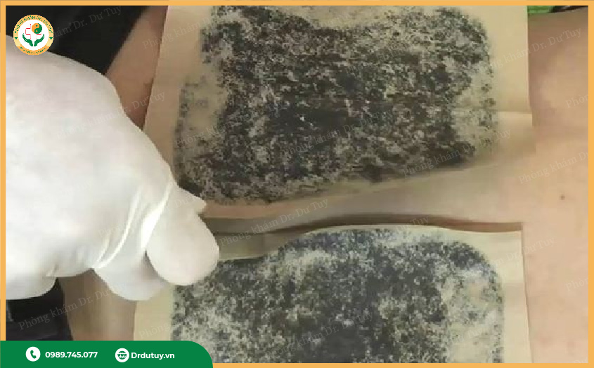 Hướng dẫn sử dụng cao dán đông y