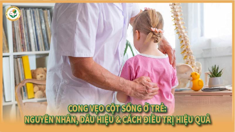 Cong vẹo cột sống ở trẻ: Nguyên nhân, dấu hiệu & cách điều trị hiệu quả