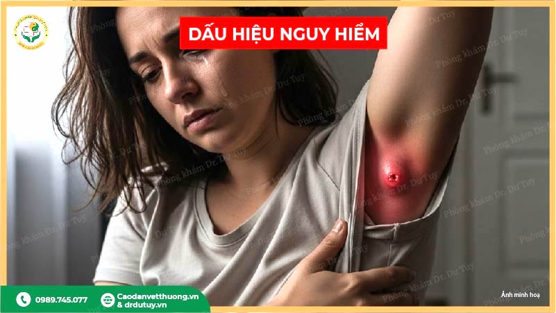 dấu hiệu áp xe nách nguy hiểm