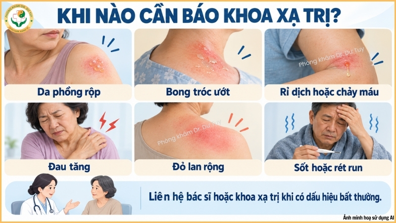dấu hiệu cần báo khoa xạ trị