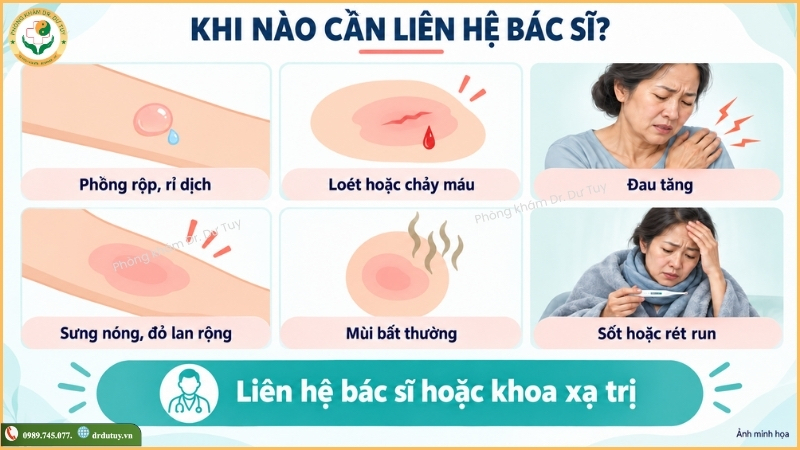 dấu hiệu cần liên hệ bác sĩ sau xạ trị