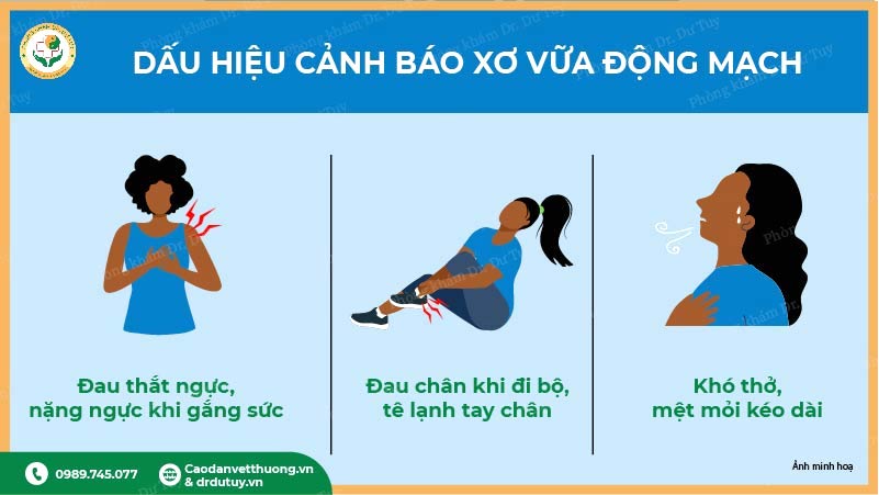 dấu hiệu cảnh báo xơ vữa động mạch