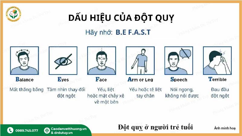 dấu hiệu đột quỵ người trẻ