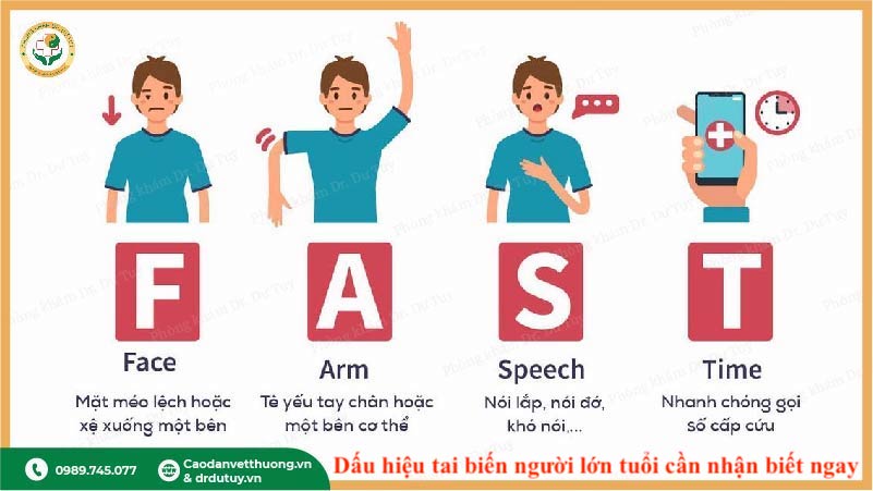 dấu hiệu fast nhận biết sớm đột quỵ ở người cao tuổi