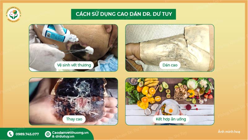 dấu hiệu hoại tử da