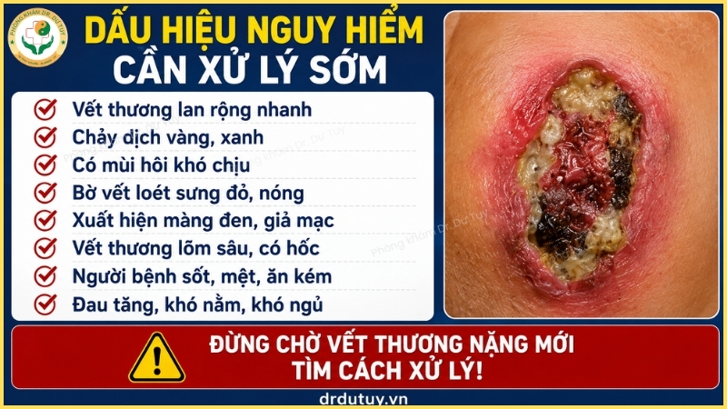 dấu hiệu nguy hiểm vết loét vùng cùng cụt